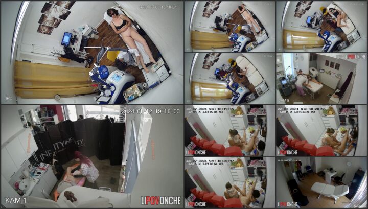 Hidden cam caught all of her hair removal treatment 80